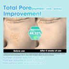 Some By Mi PDRN Spirulina Soothing Repair Serum (50ml)