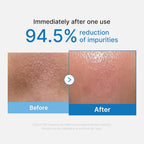 medicube Zero Pore Blackhead Cleansing Oil | Makeup Remover for all skin types, Daily Moisture Facial Cleanser, Low-Irritation | Korean Skin Care 205ml