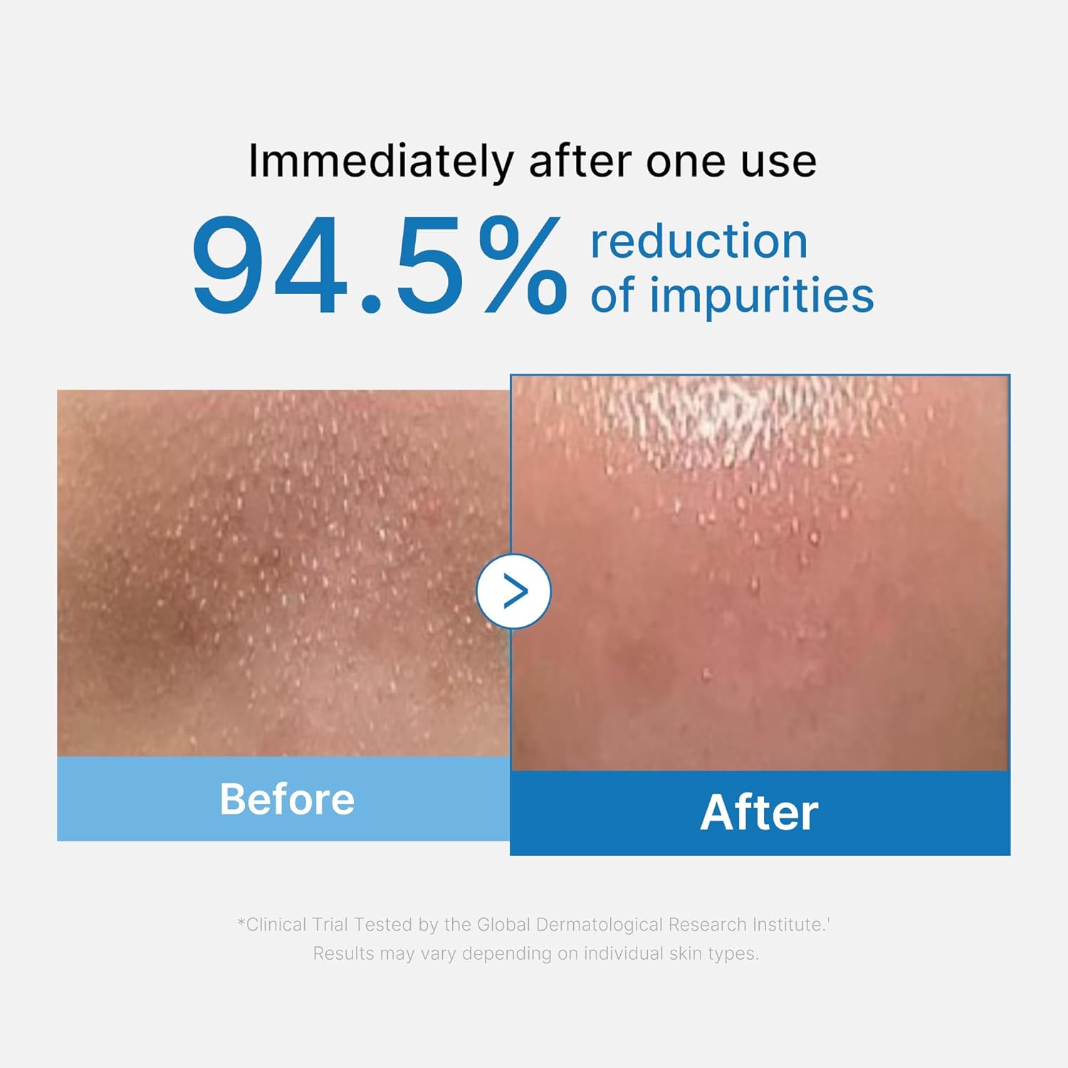 medicube Zero Pore Blackhead Cleansing Oil | Makeup Remover for all skin types, Daily Moisture Facial Cleanser, Low-Irritation | Korean Skin Care 205ml