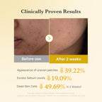 Medicube Kojic Acid Turmeric Pad | Face Toner Pads Target Dark Spots, Acne Marks