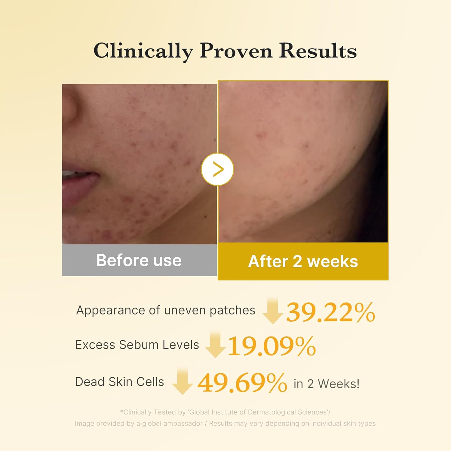 Medicube Kojic Acid Turmeric Pad | Face Toner Pads Target Dark Spots, Acne Marks