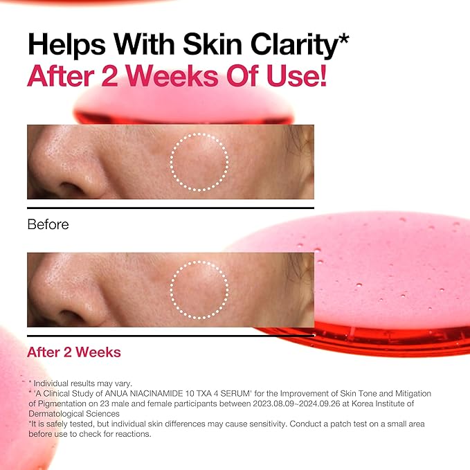 ANUA 10% Niacinamide+ 4% TXA Serum, Ceramide, Hyaluronic Acid, Tranexamic Acid, Vitamin B12 Natural color, Korean Glass Skin, Fragrance-Free, Dark Spot Serum, Korean Skincare, 30ml /1.01 fl.oz.