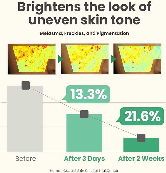 AXIS-Y Dark Spot Correcting Glow Serum 50ml / 1.69 fl. oz | Brightening Serum | Korean Skincare, Dark Spot Treatment, Hyperpigmentation Treatment