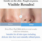Medicube Zero Pore Pad Mild 155g | Gentle Calming Toner Pads for Exfoliation, Minimizing Pores, and Blackhead Removal with PHA - Ideal for All Skin Types - Korean Skin Care