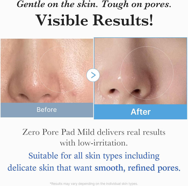 Medicube Zero Pore Pad Mild 155g | Gentle Calming Toner Pads for Exfoliation, Minimizing Pores, and Blackhead Removal with PHA - Ideal for All Skin Types - Korean Skin Care