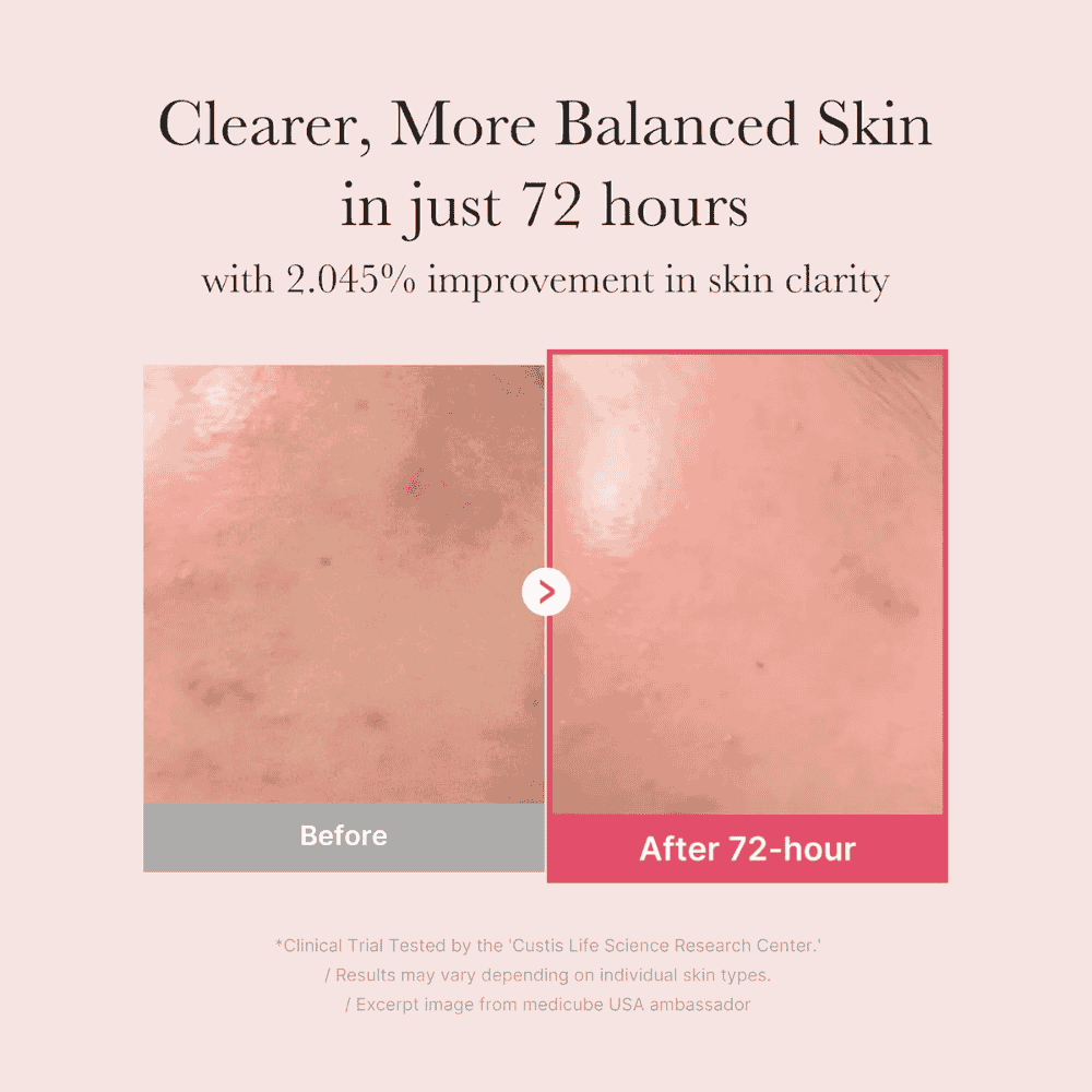 Medicube 15% TXA + Niacinamide Brightening Serum | Dark Spot & Pore Care