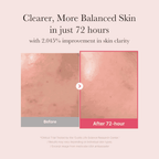 Medicube 15% TXA + Niacinamide Brightening Serum | Dark Spot & Pore Care