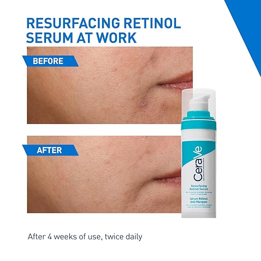 CeraVe Resurfacing Retinol Serum 30ml | Post-Acne Marks & Smooth Skin Texture