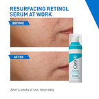 CeraVe Resurfacing Retinol Serum 30ml | Post-Acne Marks & Smooth Skin Texture