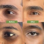 CLINIQUE All About Eyes Rich 15ml