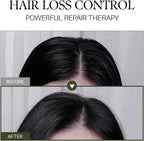 d'Alba Scalp Therapy Serum Shampoo – Hair Fall Control & Repair Vegan Shampoo (275ml)