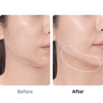 medicube AGE-R Booster Pro