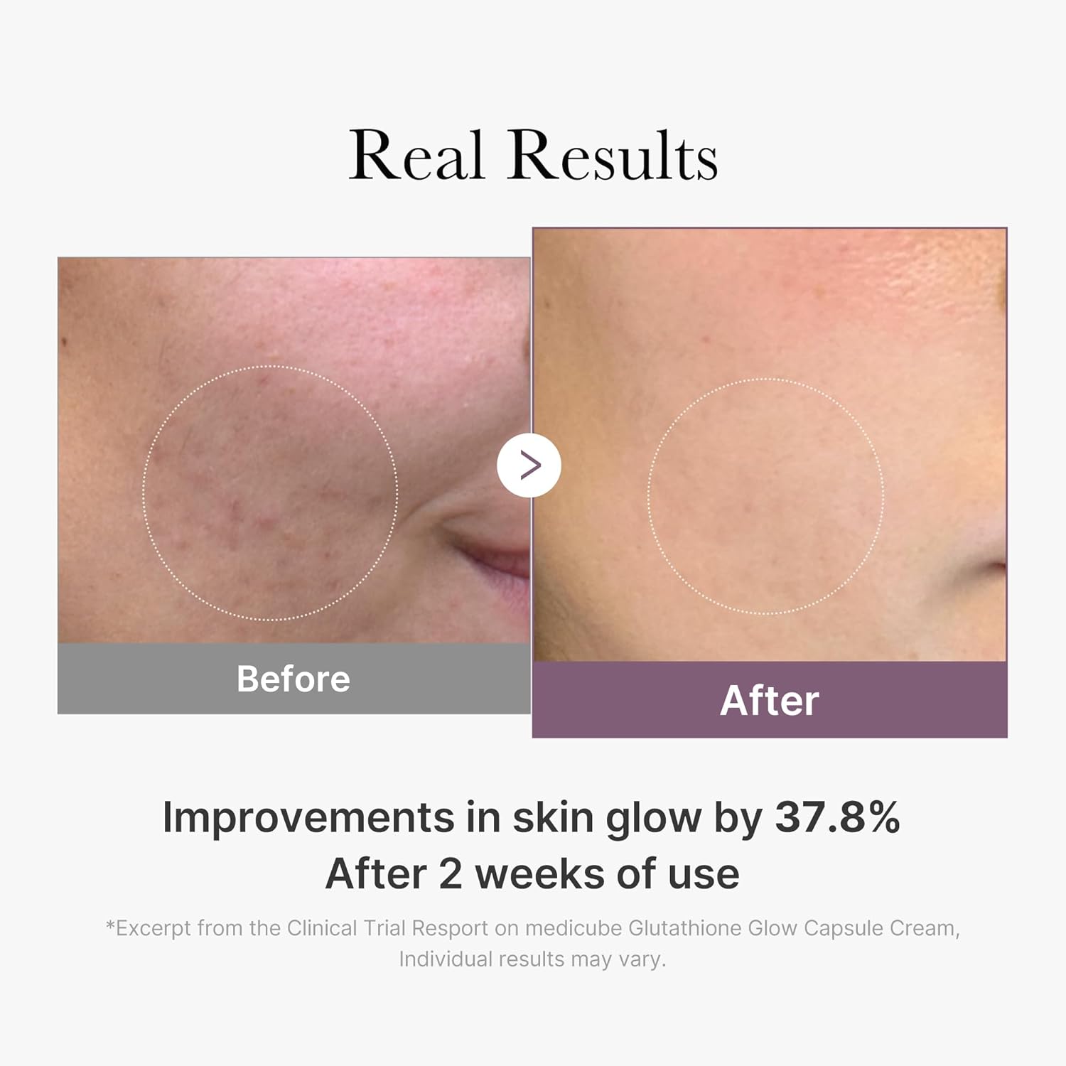 medicube AGE-R Glutathione Glow Capsule Facial Cream - Instant Lifting Moisturizer - Collagen Peptide For Hydrating Glow