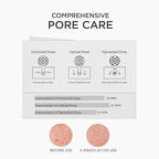 SKIN1004 Niacinamide 10% Boosting Shot Ampoule 30ml | Korean Brightening Serum for Pores, Dark Spots & Oil Control