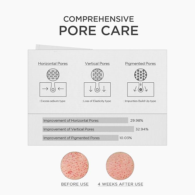 SKIN1004 Niacinamide 10% Boosting Shot Ampoule 30ml | Korean Brightening Serum for Pores, Dark Spots & Oil Control